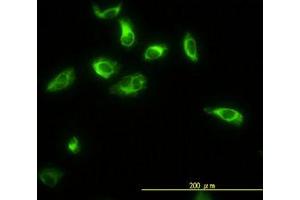 Image no. 4 for anti-Thiopurine S-Methyltransferase (TPMT) (AA 1-246) antibody (ABIN598985) (TPMT Antikörper  (AA 1-246))