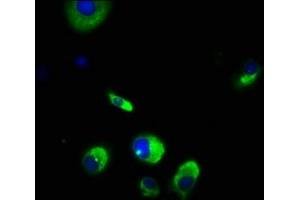 Immunofluorescence staining of MCF-7 cells with ABIN7175718 at 1:166, counter-stained with DAPI. (WDPCP Antikörper  (AA 621-737))