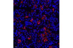 Immunofluorescence of paraffin embedded rat hypophysis using TSH (ABIN7075906) at dilution of 1:400 (400x lens) (TSHB Antikörper)