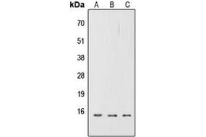 Western blot analysis of CD252 expression in A549 (A), NS-1 (B), H9C2 (C) whole cell lysates. (TNFSF4 Antikörper  (Center))