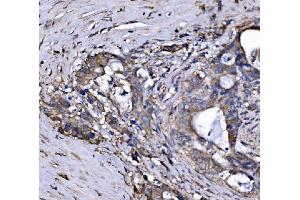 IHC analysis of FXR1 using anti-FXR1 antibody (ABIN7600093).