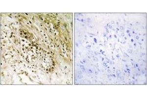 Immunohistochemistry analysis of paraffin-embedded human heart tissue, using PDZD2 Antibody. (PDZD2 Antikörper  (AA 51-100))