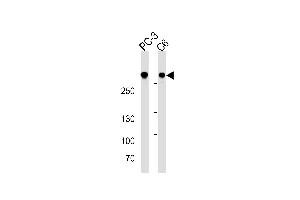 FLNA Antibody (ABIN1882243 and ABIN2838478) western blot analysis in PC-3 and C6 cell line lysates (35 μg/lane). (Filamin A Antikörper  (AA 1-360))
