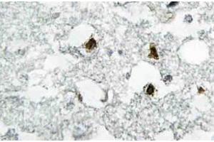 Immunohistochemistry (IHC) analyzes of p27 antibody in paraffin-embedded human brain tissue. (CDKN1B Antikörper)