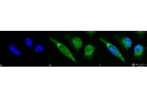 Immunocytochemistry/Immunofluorescence analysis using Rabbit Anti-GRP78 Polyclonal Antibody . (GRP78 Antikörper  (PerCP))