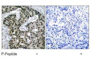 Image no. 1 for anti-Heat Shock Factor Protein 1 (HSF1) (pSer303) antibody (ABIN197025) (HSF1 Antikörper  (pSer303))