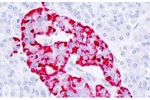 Human Pancreas, Islet: Formalin-Fixed, Paraffin-Embedded (FFPE) (CPE Antikörper  (AA 271-320))