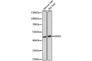 Western blot analysis of extracts of various cell lines using DDB2 Polyclonal Antibody at dilution of 1:500. (DDB2 Antikörper)