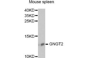 Western Blotting (WB) image for anti-Guanine Nucleotide Binding Protein (G Protein), gamma Transducing Activity Polypeptide 2 (GNGT2) antibody (ABIN6292958)