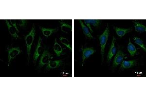 ICC/IF Image TRAP1 antibody detects TRAP1 protein at mitochondria by immunofluorescent analysis.