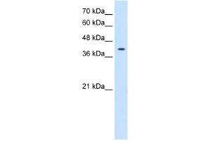 WB Suggested Anti-TSPAN12 Antibody Titration:  0. (TSPAN12 Antikörper  (Middle Region))