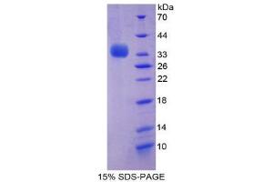 SDS-PAGE (SDS) image for Beclin 1, Autophagy Related (BECN1) (AA 1-273) protein (His tag) (ABIN1878727)