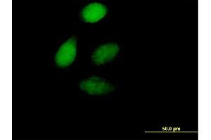 Immunofluorescence of purified MaxPab antibody to ZFP276 on HeLa cell. (ZNF276 Antikörper  (AA 1-373))
