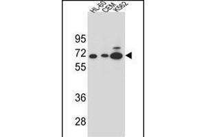Y2B Antibody (N-term) (ABIN654651 and ABIN2844347) western blot analysis in HL-60,CEM and K562 cell line lysates (35 μg/lane). (AMY2B Antikörper  (N-Term))