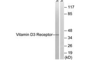 Western blot analysis of extracts from Jurkat cells, using Vitamin D3 Receptor (Ab-51) Antibody. (Vitamin D Receptor Antikörper  (AA 16-65))
