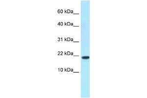 WB Suggested Anti-XAGE1D Antibody Titration: 1. (XAGE1D Antikörper  (C-Term))