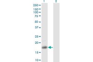 Western Blot analysis of PTN expression in transfected 293T cell line by PTN monoclonal antibody (M01), clone 5C3. (Pleiotrophin Antikörper  (AA 45-154))