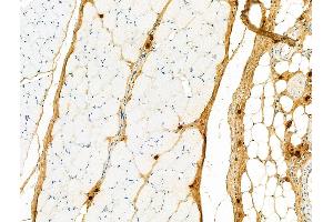 ABIN6258140 and ABIN6275931 at 1/100 staining Rat skin tissue by IHC-P. (S1PR3 Antikörper  (N-Term))