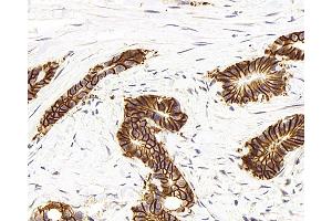Immunohistochemistry analysis of paraffin-embedded human colon using Na+/K+-ATPase alpha1 Polyclonal Antibody at dilution of 1:300. (ATP1A1 Antikörper)