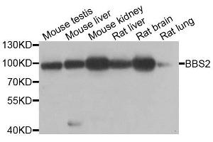 Western blot analysis of extracts of various cell lines, using BBS2 antibody. (BBS2 Antikörper  (AA 1-96))
