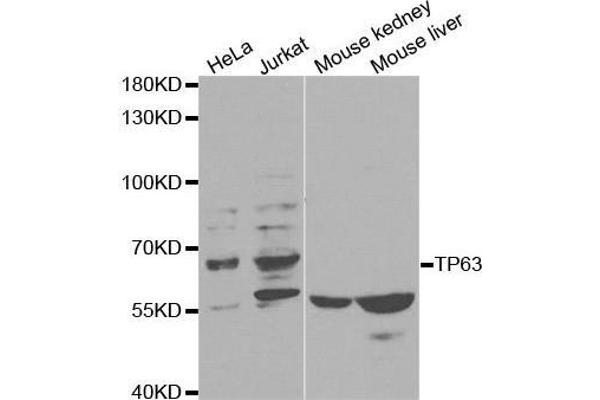 p63 Antikörper  (AA 421-680)