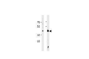 HSF1 Antibody (ABIN389069 and ABIN2839273) western blot analysis in Jurkat cell line and mouse heart tissue lysates (35 μg/lane). (HSF1 Antikörper  (Sumoylation Site))