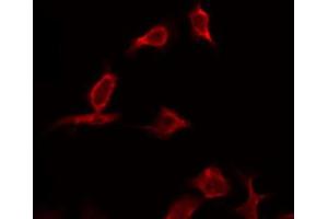 ABIN6268792 staining HeLa by IF/ICC. (Caspase 9 Antikörper  (Cleaved-Asp330))