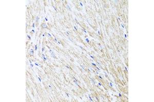 Immunohistochemistry of paraffin-embedded mouse heart using L2HGDH antibody (ABIN5975242) at dilution of 1/100 (40x lens). (L2HGDH Antikörper)
