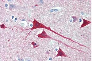 Immunohistochemistry (IHC) image for anti-Neurogranin (NRGN) (Internal Region) antibody (ABIN571065)