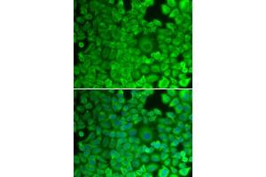 Immunofluorescence (IF) image for anti-Glycogen Synthase 1 (Muscle) (GYS1) (AA 488-737) antibody (ABIN3016178)