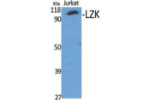 Western Blot (WB) analysis of specific cells using LZK Polyclonal Antibody. (MAP3K13 Antikörper  (Internal Region))