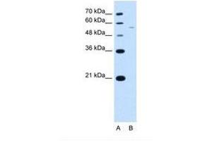 RSRC2 Antikörper  (AA 363-412)