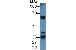 Detection of FGA in Mouse Kidney lysate using Polyclonal Antibody to Fibrinogen Alpha Chain (FGA) (FGA Antikörper  (AA 34-255))
