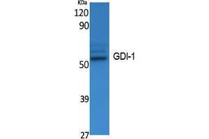 Western Blotting (WB) image for anti-GDP Dissociation Inhibitor 1 (GDI1) (C-Term) antibody (ABIN3187603) (GDI1 Antikörper  (C-Term))