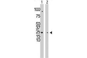 The CMPK1 polyclonal antibody  is used in Western blot to detect CMPK1 in HepG2 cell lysate (Lane 1) and mouse cerebellum tissue lysate (Lane 2) . (Cytidine Monophosphate (UMP-CMP) Kinase 1, Cytosolic (CMPK1) (C-Term) Antikörper)