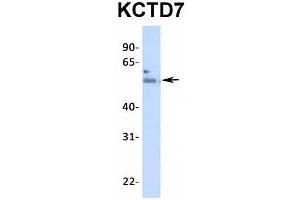 Host:  Rabbit  Target Name:  KCTD7  Sample Type:  Human Fetal Heart  Antibody Dilution:  1. (KCTD7 Antikörper  (N-Term))