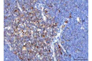IHC analysis of TCR alpha/TRAC using anti-TCR alpha/TRAC antibody (ABIN6719654). (TRAC Antikörper  (AA 1-114))