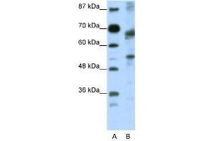 WB Suggested Anti-TCF12  Antibody Titration: 0. (TCF12 Antikörper  (N-Term))