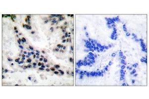 Immunohistochemistry (IHC) image for anti-Histone Deacetylase 1 (HDAC1) (C-Term) antibody (ABIN1848594) (HDAC1 Antikörper  (C-Term))