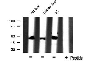 Western blot analysis of extracts of various celllines,using HSP60 antibody. (HSPD1 Antikörper)
