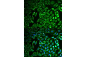 Immunofluorescence (IF) image for anti-F-Box Protein 11 (FBXO11) antibody (ABIN1877139) (FBXO11 Antikörper)