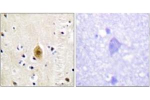 Immunohistochemistry analysis of paraffin-embedded human brain, using Mst1/2 (Phospho-Thr183) Antibody. (MST1/MST2 (AA 149-198), (pThr183) Antikörper)