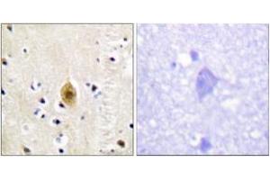 Immunohistochemistry analysis of paraffin-embedded human brain, using Mst1/2 (Phospho-Thr183) Antibody. (MST1/MST2 (AA 149-198), (pThr183) Antikörper)