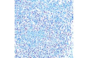 Immunohistochemistry of paraffin-embedded mouse spleen using SNRPB Rabbit pAb (ABIN6134519, ABIN6148214, ABIN6148215 and ABIN6219175) at dilution of 1:100 (40x lens). (SNRPB Antikörper  (AA 1-100))