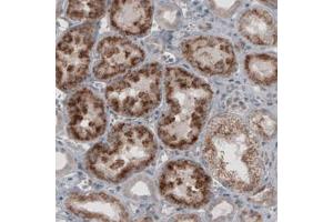 Immunohistochemical staining (Formalin-fixed paraffin-embedded sections) of human kidney with ACAA1 monoclonal antibody, clone CL2663  shows granular cytoplasmic immunoreactivity in renal tubules.