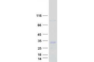Western Blotting (WB) image for Deoxyguanosine Kinase (DGUOK) (Transcript Variant 1) protein (Myc-DYKDDDDK Tag) (ABIN2719393)