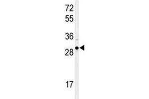 Western blot analysis of XBP1 antibody and Ramos lysate. (XBP1 Antikörper  (AA 62-91))