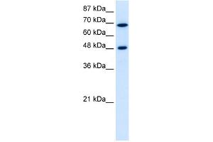 Western Blotting (WB) image for anti-Ribosomal RNA Processing 9, Small Subunit (SSU) Processome Component, Homolog (RRP9) (Middle Region) antibody (ABIN2778911)