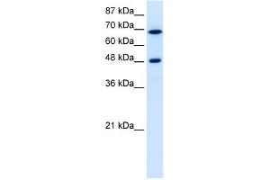 WB Suggested Anti-RRP9 Antibody Titration:  5. (RRP9 Antikörper  (Middle Region))