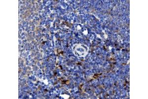IHC analysis of NOXA2/p67phox/NCF2 using anti-NOXA2/p67phox/NCF2 antibody (ABIN7599462). (NCF2 Antikörper  (AA 1-526))